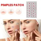 24/36Pcs Acne Patch Pimple Treatment Invisible Spot' Sticker Beauty Tools