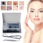 Portable Tag Spot Wart Tattoo Freckle Removal Anti-aging Machine Home Spa Use