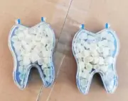 2 Boxes Dental Oral Temporary Crown Material For Molar Teeth Veneers Crowns