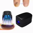 Nail Fungus Laser Device Light Therapy Onychomycosis Toes Treatment Tool Kit
