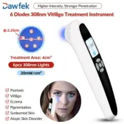 UVB Light Therapy 308nm Excimer Phototherapy for Hands Face Feet Skin Disorder