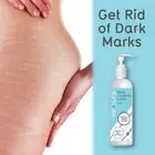 NIP & TUCK STRETCH MARK LOTION - 250ml Stretch Mark Reducer