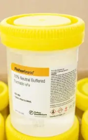Fisherbrand 10% Neutral Buffered Formalin Prefilled Containers, 1 C (3374824)