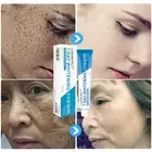 Remove Freckle Melanin Dark Spots Melasma Brightening Whitening moisturize Cream