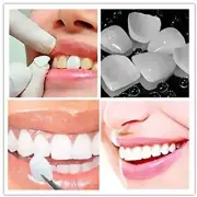 5Bags Dental Temporary Crown Veneers for Anterior Front Teeth Whitening