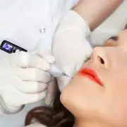 Handheld Laser Spotlight Pen Tattoo Mole Dark Spot Acne Scar Removal