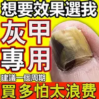 在飛比找蝦皮購物優惠-【正品保證】灰指甲真菌治療液去灰指甲特效抑菌液反復增生厚空甲