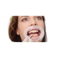 在飛比找蝦皮購物優惠-牙齒口腔 義獲嘉 三維立體開口器 3D張口器擴嘴器O型開口器