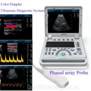 Color Doppler Ultrasound Scanner Portable Laptop Machine Color Diagnostic