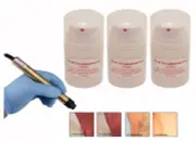 New Gel de post-traitement au laser 150 ml À utiliser avec tous les Bio Avance