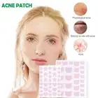 Waterproof Acne Pimple Patches Hydrocolloid Sticker Pimples Removal Facial Car ]