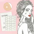 108 Pcs Acne Pimple Plasters Patch Removal Blemish Control Skin Facial Care