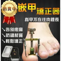 在飛比找蝦皮購物優惠-嵌甲 凍甲 卷甲 指甲矯正器 甲溝炎 指甲內陷