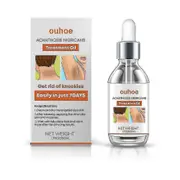 Attdx Acanthosis Nigricans Oil Get Rid Of Knuckies 50ml -n
