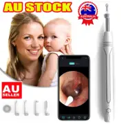 Smart Visual Earpick Ear Wax Removal Cleaner WiFi Ear Stick Endoscope Camera RO