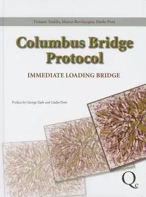 Columbus Bridge Protocol: Surgical and Prosthetic Guidelines for an Immediately Loaded, Implant-supported Prosthesis in the Eden