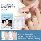 Pimple Patches Hydrocolloid Master Skin Tag Remover Patch Acne Spot Treatment