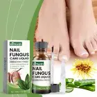 Nail Treatment Fungus Anti Fungal Toe Removal Care Infection Liquid Solution