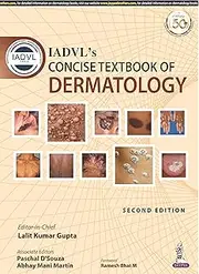 IADVL's Concise Textbook of Dermatology