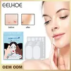 Tag Remover Patch Ance Pimple Patches Acne Spot Treatment Hydrocolloid Master