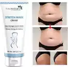 7Days Organic Stretch Mark Cream - 100gms | Reducing Stretch Marks & Scars