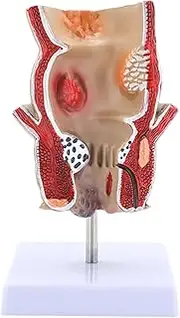 Wmqbjta Human Pathology Rectal Model Teaching Aid for Research Classroom Study