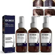 3x Hair Growth Spray Promote Hair Thick Growth Liquid Scalp Damaged Treatment Massage Repair Anti-fall Anti Hair Loss Serum