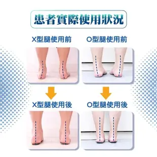 【Expert Gel】O型腿X型腿矯正鞋墊(O型腿 X型腿 矯正)