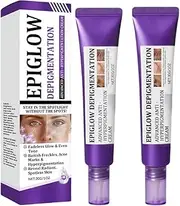 Retinol Anti-Pigment Face Cream - Spot Treatment for Women, Melasma Removal & Anti-Aging Formulation - Brightening Cream for Even Skin Color & Dark Spot Correction (2)
