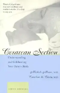 在飛比找博客來優惠-Cesarean Section: Understandin