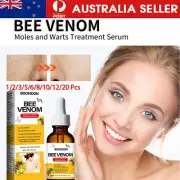 Bee Skin Tag Removal Treatment Drops Body Care Mole Corn Wart Remover