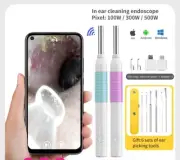 Wireless Smart Vision Ear Stick Ears Picker Precision Endoscope Camera Otoscope