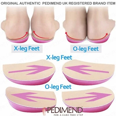 Pedimend Achilles Tendonitis Support O/X-Legs Insoles for Flat Feet Heel Spurs