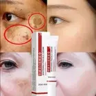 Effective Whitening Freckle Cream Remove Dark Spot Cream Removal Melanin Melasma