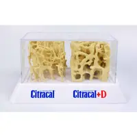 在飛比找蝦皮購物優惠-骨質疏鬆 人體醫學模型 Bone Density Model