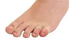 Toe Spacer Visco-GEL Little ToeBuddy One Size Fits Most Pull-On Toe (PK/1)