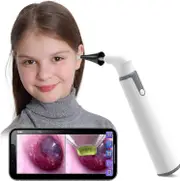 Wireless Otoscope Ear Camera With Dual View, 3.9mm 720phd Wifi Ear Scope With 6 Led Lights For Kids