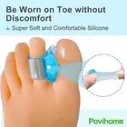 3 Pairs Soft Bunion Spacers Silicone Gel Toe Separator Thumb Corrector Foot ECM