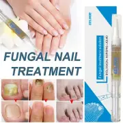 Nail Fungal Treatment Anti Fungus Infection Biological Natural Repair Solution
