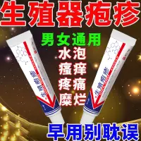 在飛比找蝦皮購物優惠-Sexually transmitted virus inf