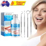 Tooth Repair Kit For Broken Teeth Tooth Repair Granules Temporary Tooth Repair