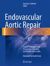 在飛比找誠品線上優惠-Endovascular Aortic Repair: Cu