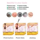 Mole Remover Pen 12 Gears LCD Screen Freckle Removal Skin Spots Beauty Pen W XAT