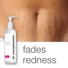 DR COMPLEXION 250ml REGENERATING DUEL CONTROL STRETCH MARK LOTION