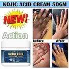 Dark Skin Ultra Whitening Lightening Brightening Age Spot Bleaching Cream 50g