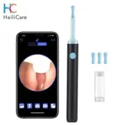 3.9mm Wireless Silicone Ear Spoon Endoscope Ear Wax Remover Luminous Otoscope