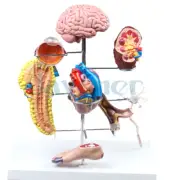 Human Diabetes Model Complications Cerebral Cardiac Pancreas Neuronal Foot Learn