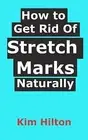 How to Get Rid Of Stretch Marks Naturally by Hilton, Kim -Paperback