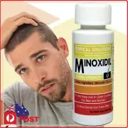 Minoxidil 5% Mens Hair Loss Drops Treatment 1-6 Months Generic