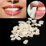 Dental Ultra Thin Veneers Resin Porcelain Temporary Teeth Whitening Film